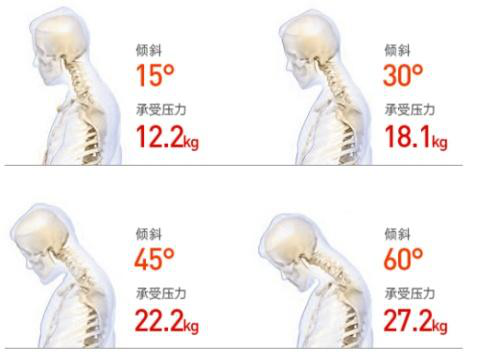 頸椎僵硬怎么辦？三步告別頸椎煩惱