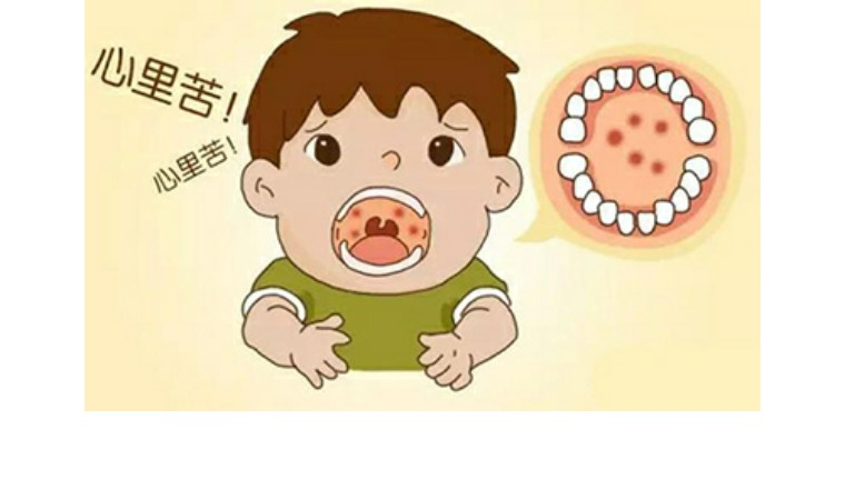 皰疹性咽峽炎高發(fā)，這些知識(shí)要了解！